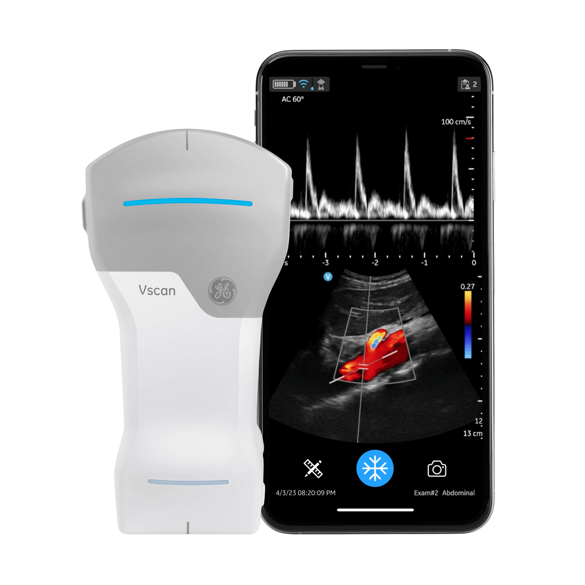 Vscan Extend Dual R2 Vscan Extend Dual R2