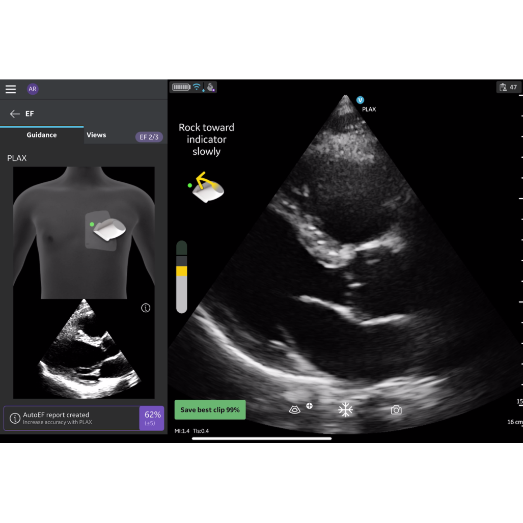 Vscan Extend Dual R2 Vscan Extend Dual R2